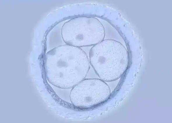 做试管用供卵需要多少钱&做供卵试管有合法,采用扩宫术治疗宫腔粘连可以怀孕