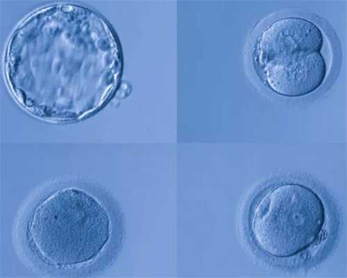 厦门代孕医院供卵,天津试管助孕公司哪家好-胎儿22号染色体异常引产后还可以