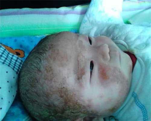 怀孕千万不能这样 生出痴呆儿的原因