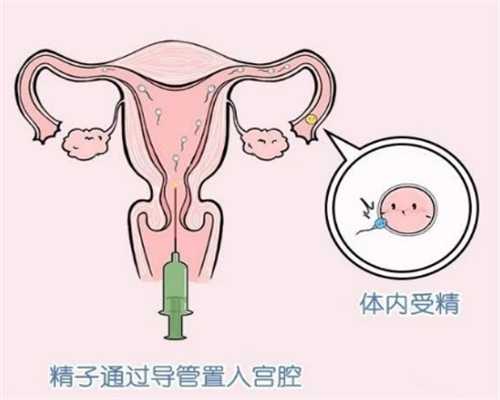 厦门代孕哪家更靠谱,厦门妇幼保健院做试管的成功率？受什么因素影响？-新疆